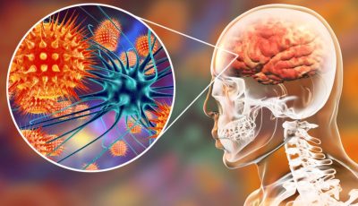 أول تعليق من الصحة على وفاة 4 أشقاء.. هل الالتهاب السحائي السبب؟