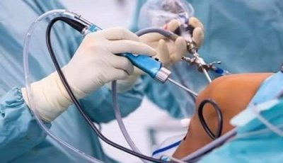 تكلفة عملية الرباط الصليبي بالمنظار في مصر 2025: دليلك لاختيار أفضل طبيب