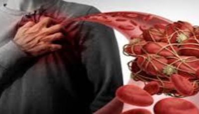 عراض مؤلمة لإرتفاع الكوليسترول.. ما هي وكيفية التخلص منها