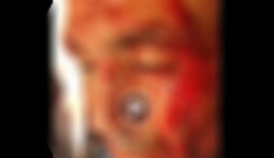 بسب نزاع قضائى.. تعدى شخصين على آخر بسلاح أبيض بالدقهلية