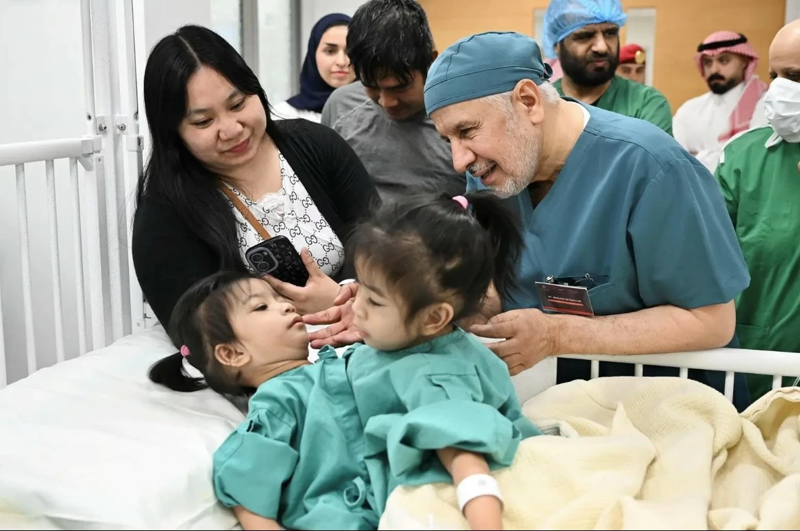 بدء عملية فصل التوأم الملتصق الفلبيني «أوليفيا وجيانا» – أخبار السعودية
