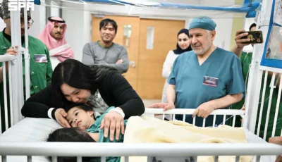 بعد عملية الـ6 ساعات.. نجاح فصل التوأم الفلبيني «أوليفيا وجيانا» – أخبار السعودية
