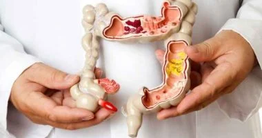 حالة مرضية بالقولون قد تسبب التهاب المفاصل.. ما هى؟