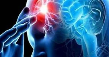 لماذا تزداد السكتات الدماغية صباحا وما طرق الوقاية؟
