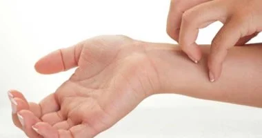 للوقاية من العدوى.. التصرف الصحيح عند التعرض للدغة قراد أو بعوض