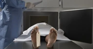 جدل فى كوريا بسبب استخدام جلد الجثث فى علاج تجميلى.. اعرف التفاصيل