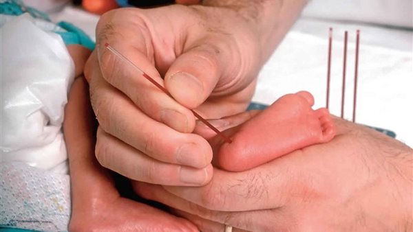 عينة دم تحمي الطفل من مضاعفات خطيرة، معهد التغذية يكشف أهمية فحص 19 مرضا وراثيا