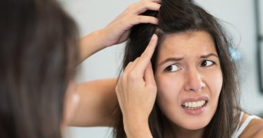 5 زيوت للشعر تزيد من حدة قشرة الرأس.. منها الزيوت العطرية