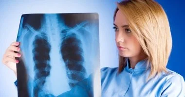 اليوم العالمى لسرطان الرئة.. 10 علامات مبكرة لا ينبغى تجاهلها