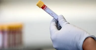 اختبار دم جديد مدعوم بالذكاء الاصطناعى يكشف الإصابة بسرطان الكبد