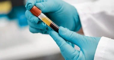 قبل إجراء أى تحليل.. أسئلة لازم تسألها للمعمل لدقة النتيجة والتوقيت الصحيح