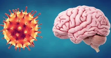 ورم في المخ أم سكتة دماغية.. 10 علامات عصبية تبدو بسيطة لا ينبغي تجاهلها