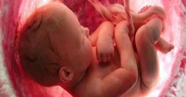 ولادة توأم حى بعد موت الأم.. استشارى يوضح كيف يعيش الجنين دون الأم؟