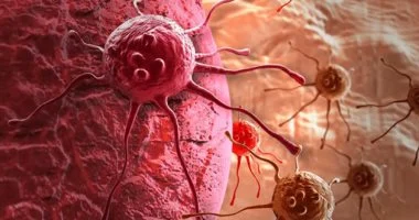 من خلل صغير في الـDNA إلى نمو خارج السيطرة.. كيف تبدأ الخلايا السرطانية؟