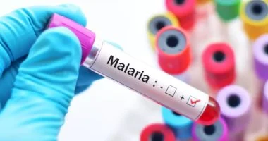 وفاة عاملين بالملاريا فى مطار بألمانيا بعد وصول بعوضة إلى الطائرة