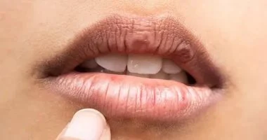 لون الشفاه غير الموحد.. كيف تعتنين به دون الإضرار ببشرتك؟