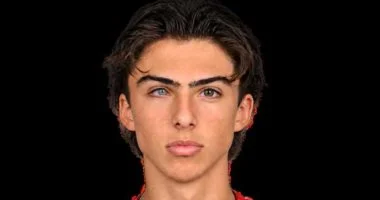 عين من أمه وعين من أبوه.. التفسير العلمى للون عينى ابن ارتيتا المختلفين