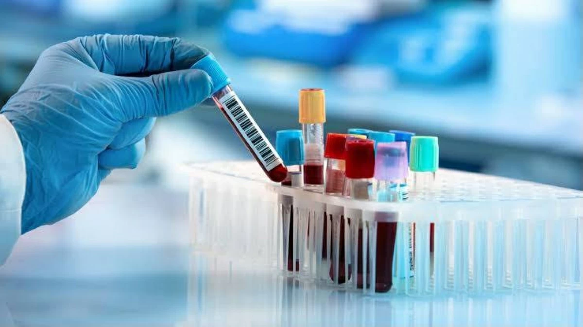 الدواء الأمريكية توافق على اختبار للكشف عن سرطان القولون.. هل يُغني عن المنظار؟
