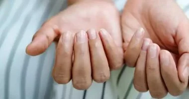 قبل ما تعمل تحاليل.. 5 تغيرات على الأظافر تكشف مشكلات صحية خفية