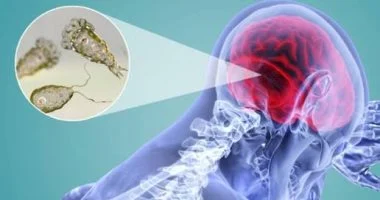 عدوى نادرة.. وفاة مراهقة أمريكية بسبب الأميبا الآكلة للدماغ